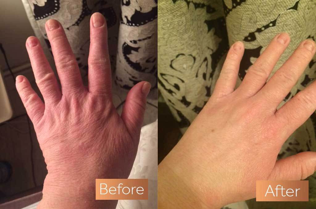 Kim hands before and after