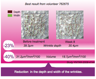Comparison of depth and width of wrinkles after consuming collagen
