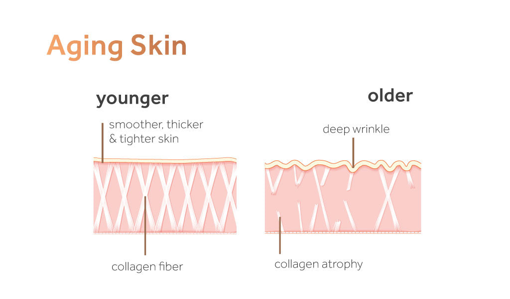 Image showing the difference between young and aging skin in terms of collagen fibre and atrophy.