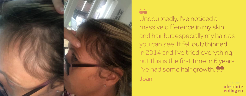 Two photos showing close-up improvements to a woman's hair alongside a quote on a yellow background about how Absolute Collagen helped with her hair