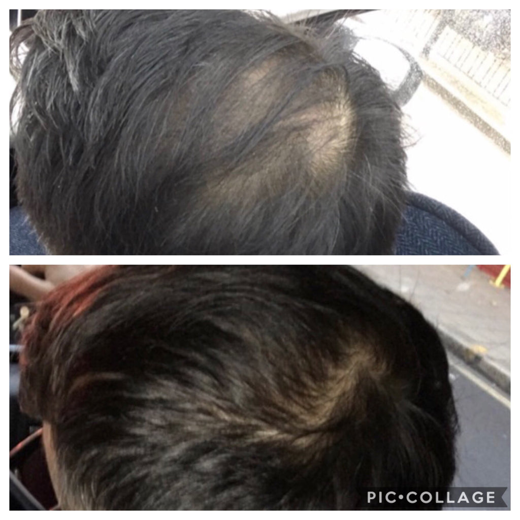 Before and after hair with absolute collagen 