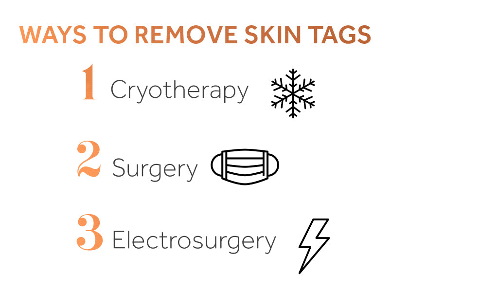 Image showing various treatments for skin tags