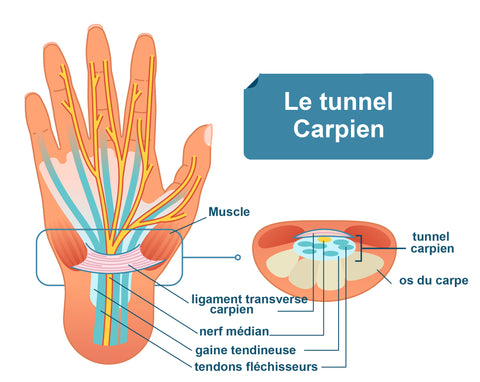 Le syndrome du canal carpien – Pharmunix