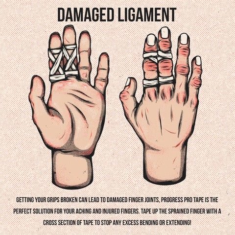 damaged jiu jitsu fingers