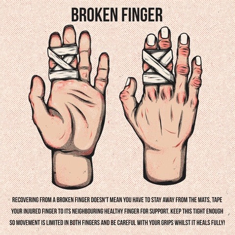 Broken jiu jitsu fingers