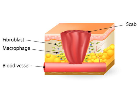 Diagram of the inflammatory phase of a wound