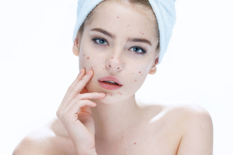 Why Are Red Dots & On Skin? [7 Skin Conditions] – bioClarity