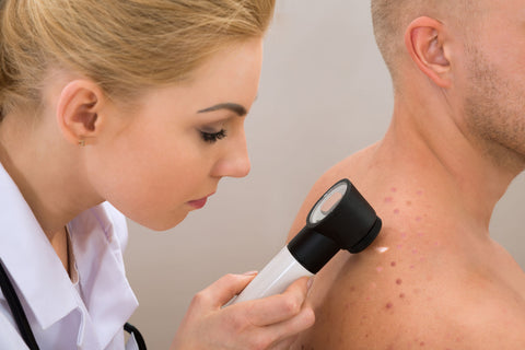 how genetics play a role in acne
