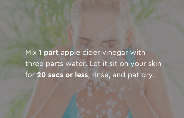 directions for using apple cider vinegar to get rid of acne