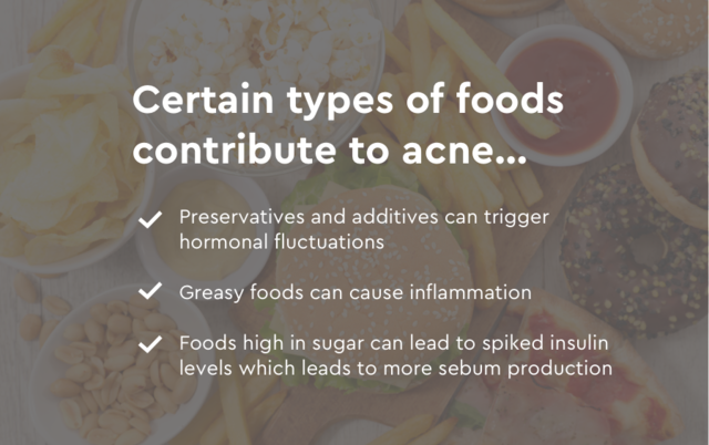 certain foods can cause acne