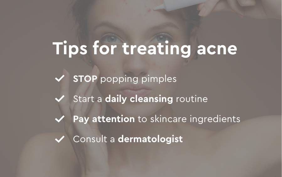 Top tips for treating acne image