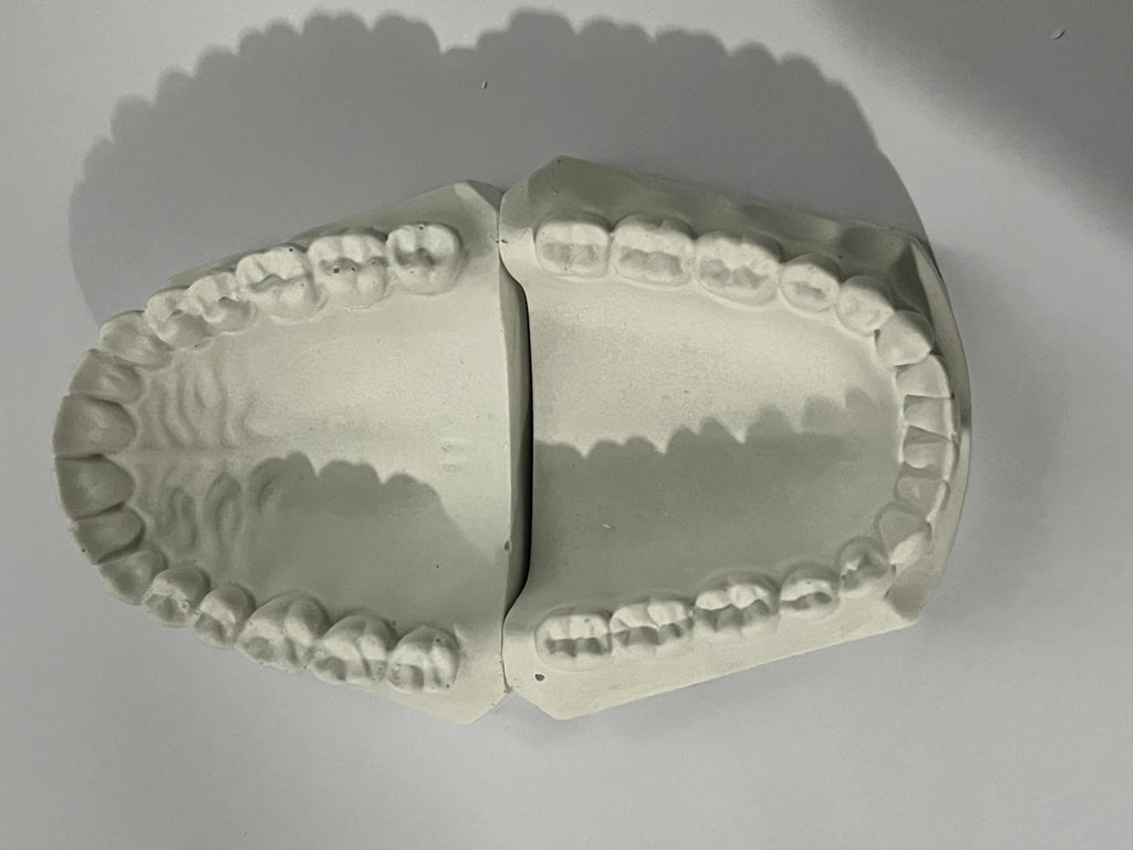 Tipodonto Modelo de yeso dentado – Deposito Dental Molar