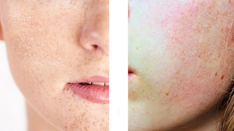 face dry skin