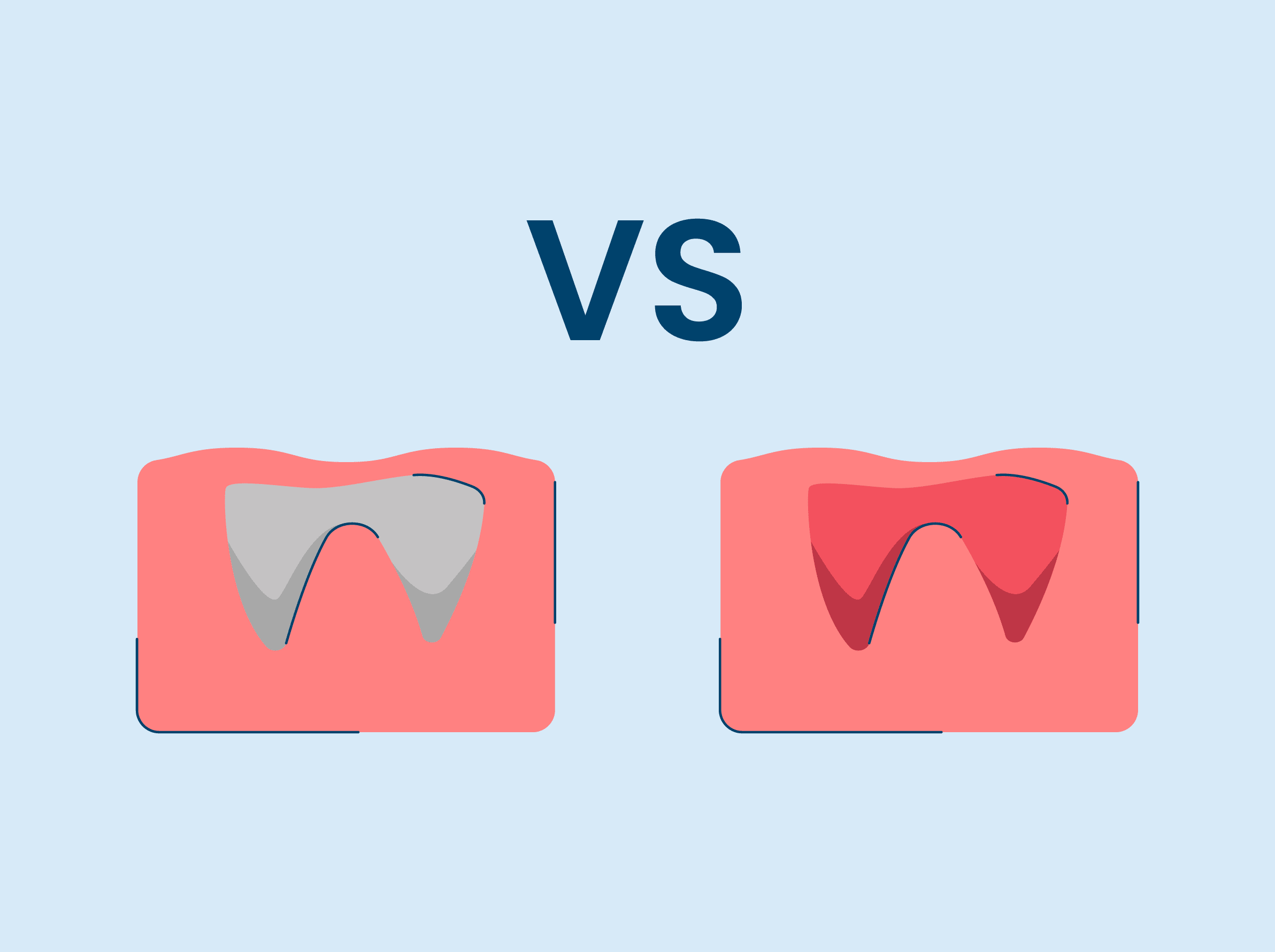 Dry Socket Vs Normal Socket After Tooth Extraction 5770