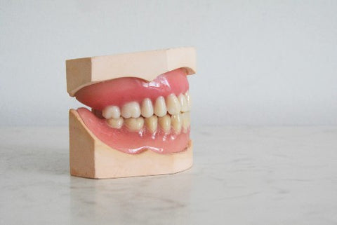 Molded model of teeth and gums