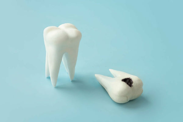causes of white specks on teeth