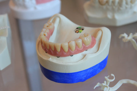 Model of teeth and gums with yellow teeth