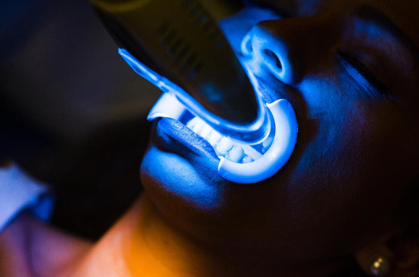 pros of laser teeth whitening