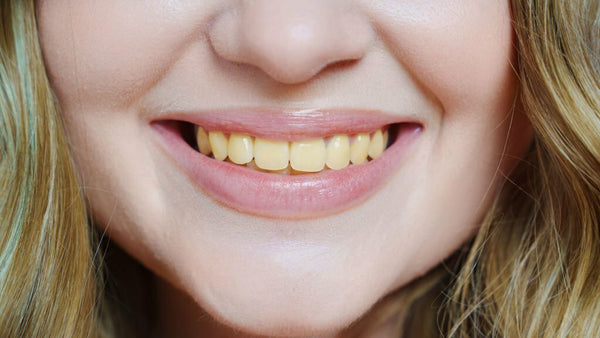 why do british people have yellow teeth