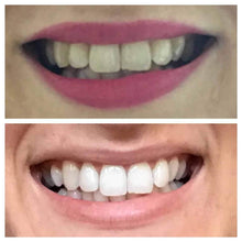 Floyd Mayweather's Snow Teeth Whitening™ At-Home System ...