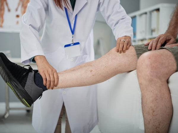 Varicose Veins: Causes, Prevention and Treatments