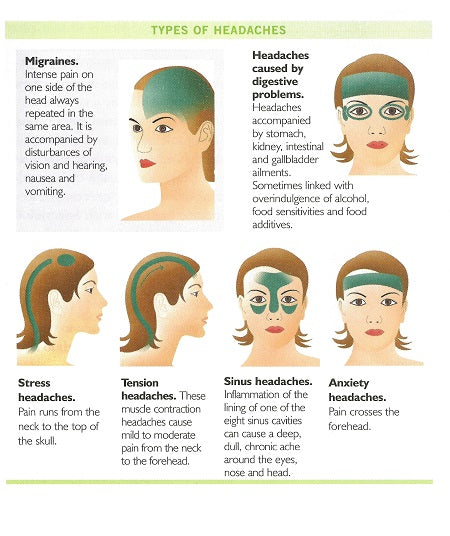 Infographic showing the difficult types and causes of headaches