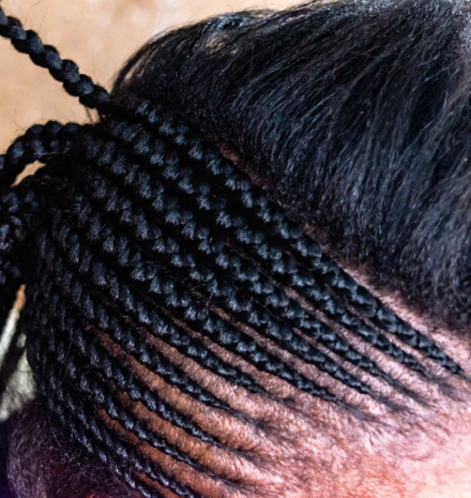 14 Extraordinary Alopecia Camouflage Cornrows By Braids By Necole  Black  Hair Information