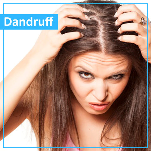 Dandruff