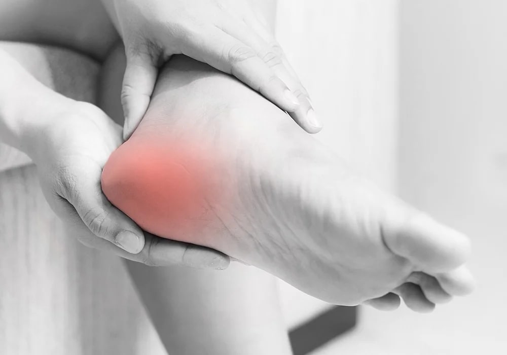 Plantar fasciitis advice