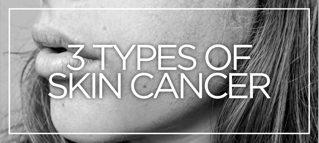 The 3 types of skin cancer you need to know – SParms | Sun Protection