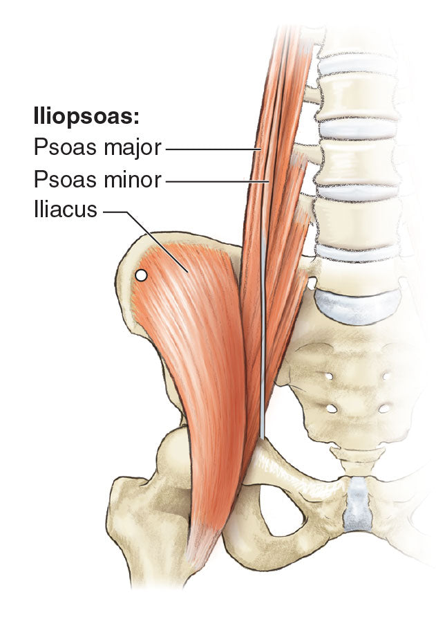 Figure 3.17 Trigger point in the iliacus.