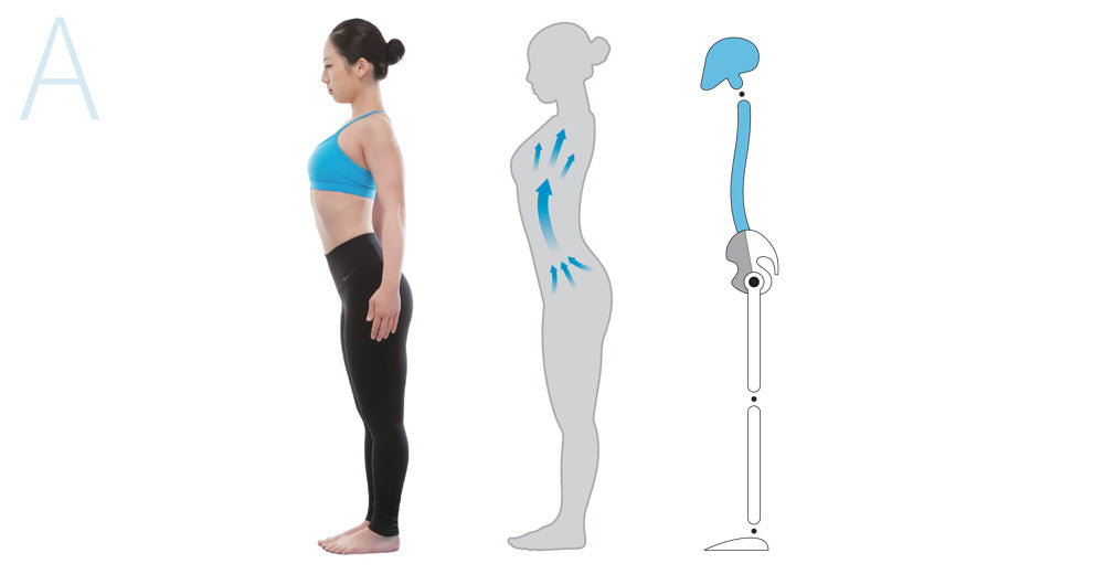 Figure 3.15. Anterior expansion Type A.