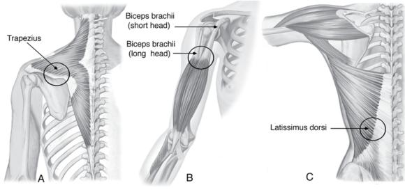 Attachments of muscles onto bones (A) directly, or indirectly through a (B) tendon or (C) aponeurosis.