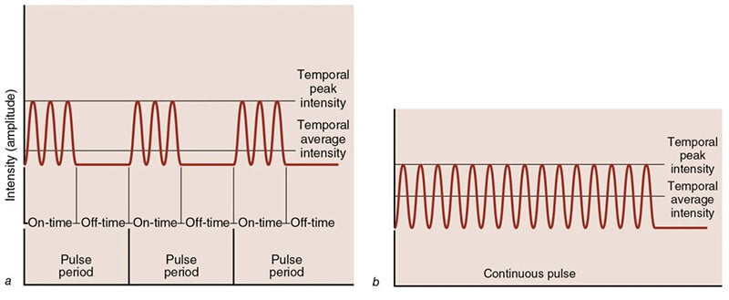 (a) In pulsed ultrasound, energy is generated only during the &quot;on&quot; time. Duty cycle is determined by the ratio of &quot;on&quot; time to pulse, in this case 50%. (b) Continuous ultrasound is shown.