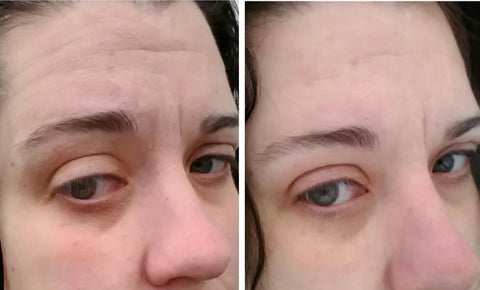 Before and After effects of EGF Recharging Serum