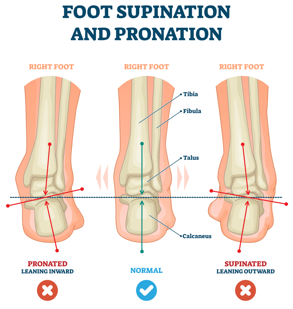 Over-Supination Explained
