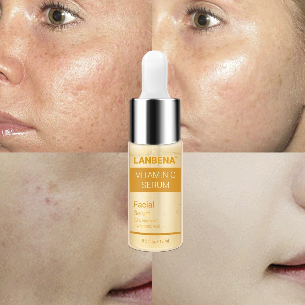 Lanbena Vitamin C Whitening Serum Hyaluronic Acid Face Cream Snail Remover Freckle Speckle Fade Dark Spots Anti Aging Skin Care