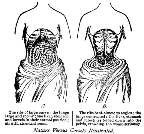 Corset-shape-bones