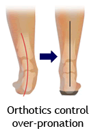 Orthotics correct over-pronation