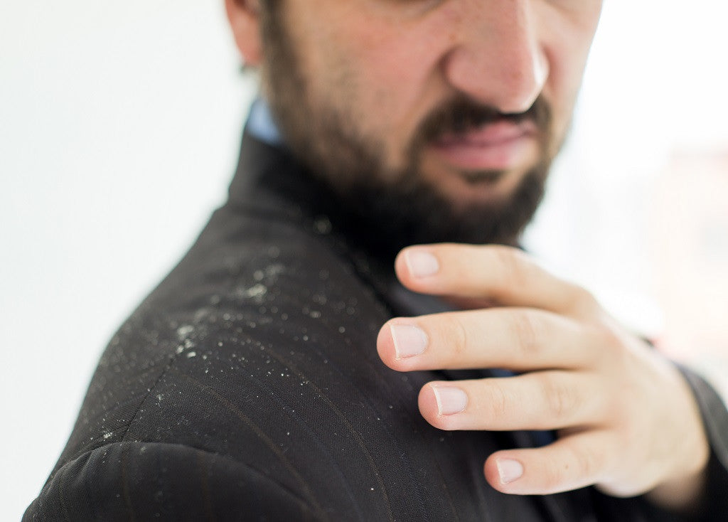 What is beard dandruff and how to treat it
