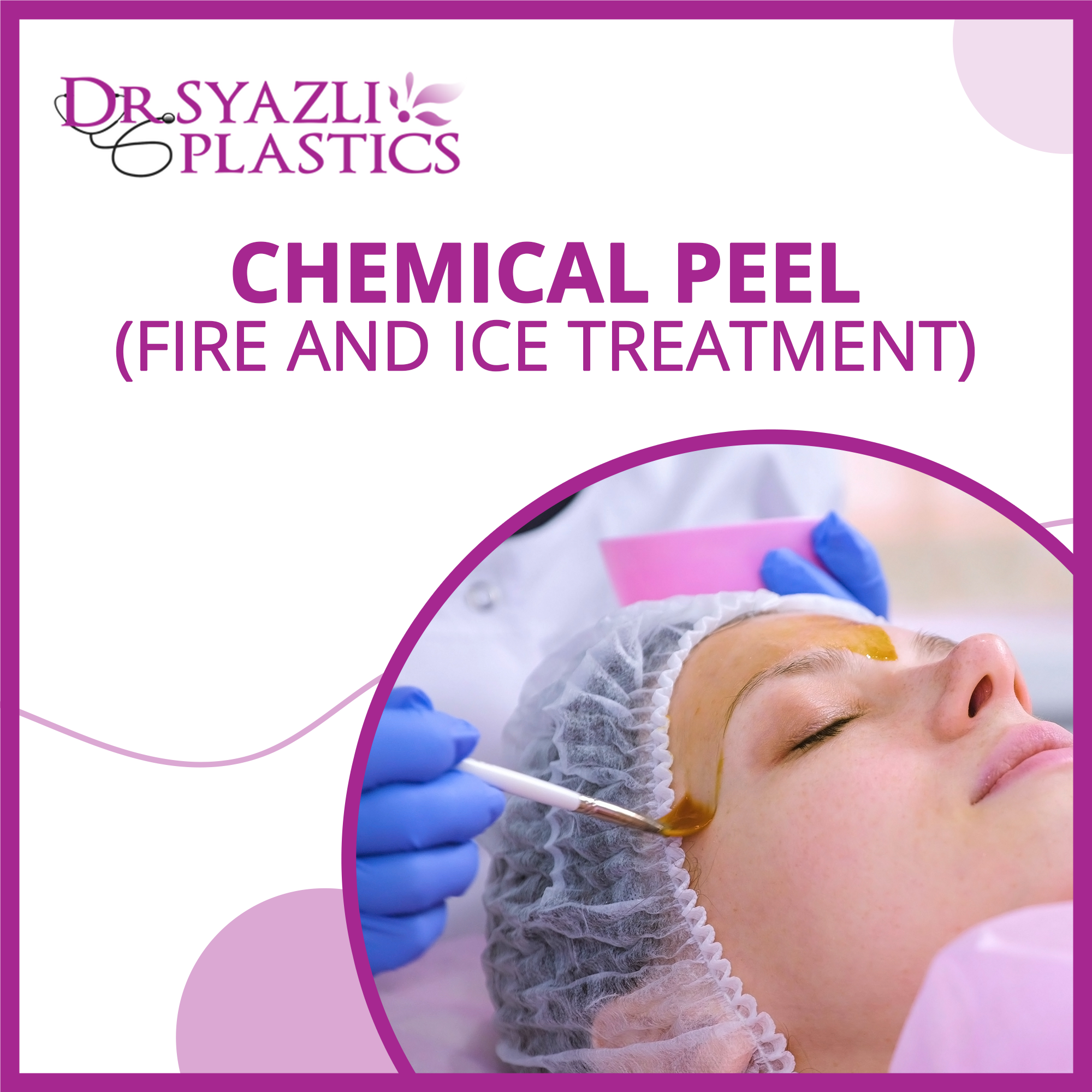 Dr. Syazli Plastics - Chemical Peel (Fire and Ice Treatment) - Default Title - DoctorOnCall Online Pharmacy