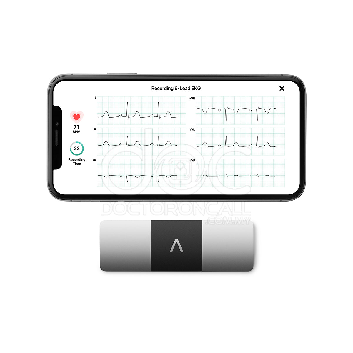 AliveCor KardiaMobile 6L - 1s - DoctorOnCall Farmasi Online