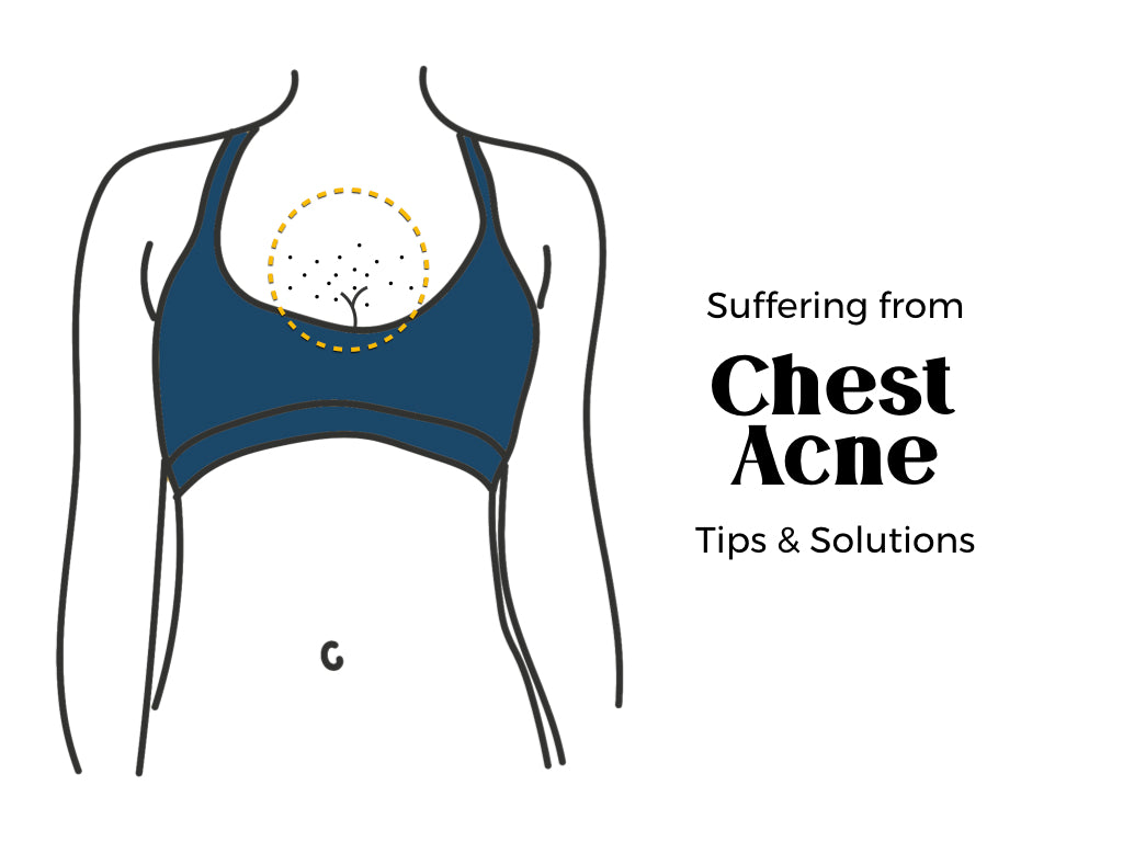 Chest Acne Treatments and Solutions 