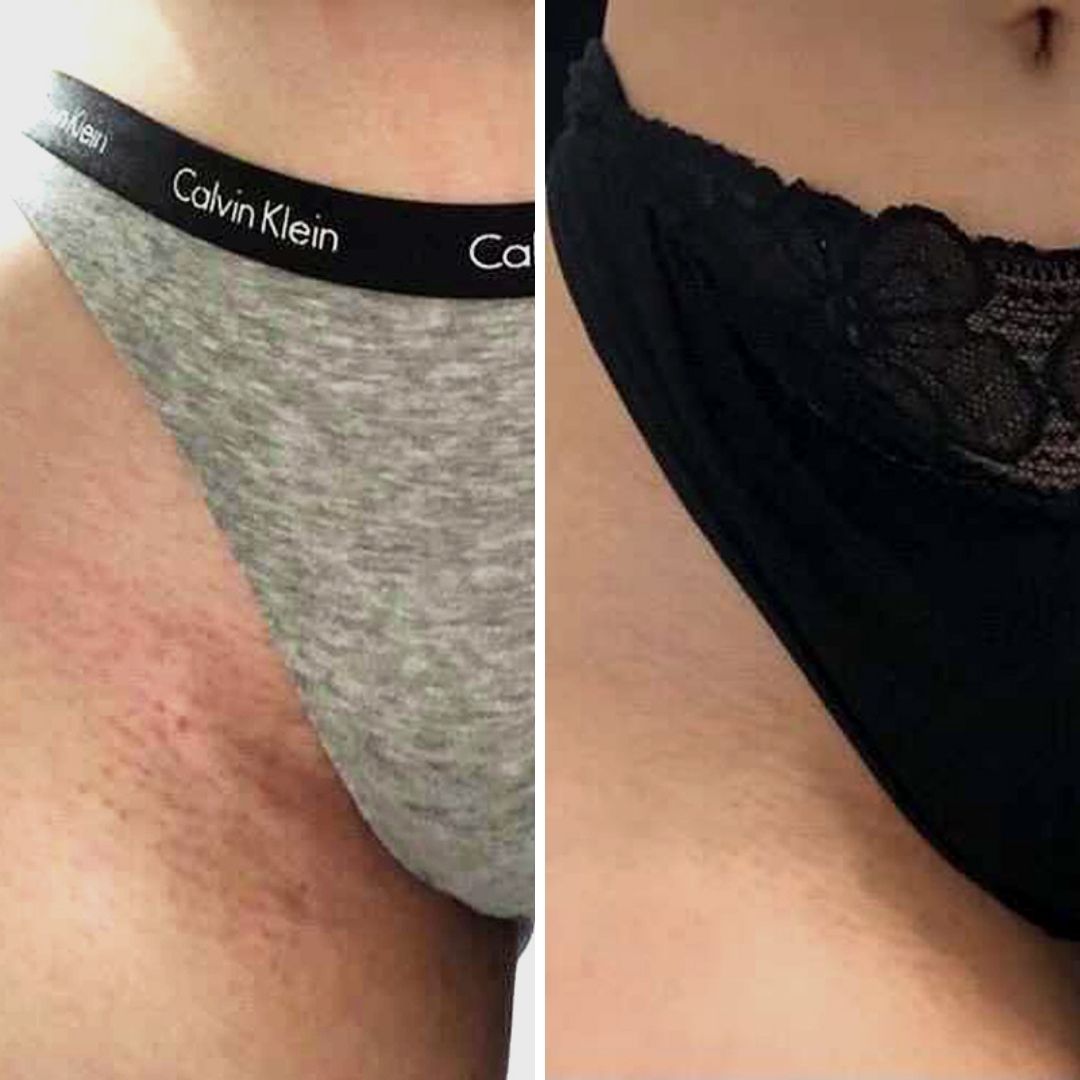 Before & After