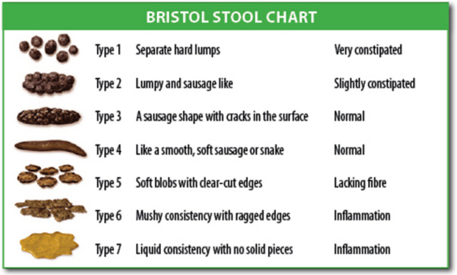 Bristol stool chart