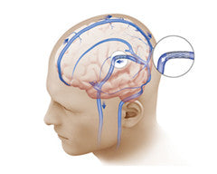 Intracranial Stents Coating