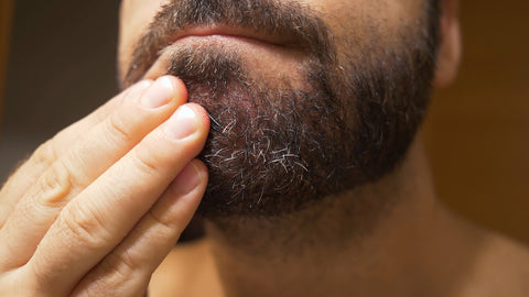 Close up image of chin beard growth