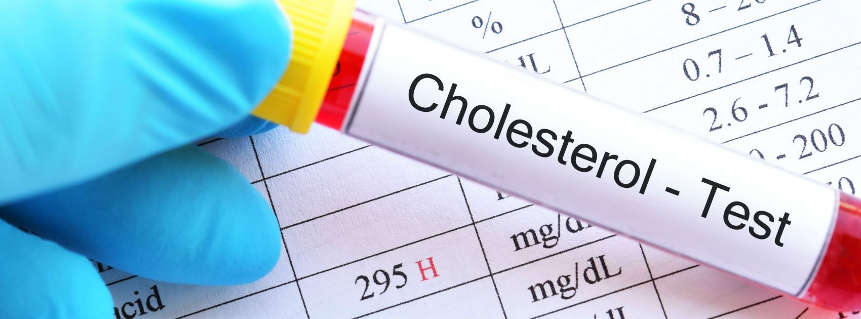 Understanding Cholesterol Test Results Ldl Hdl Total Step One Foods 2181