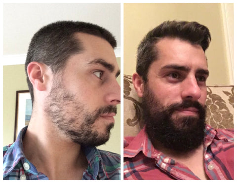 bearded man before and after biotin