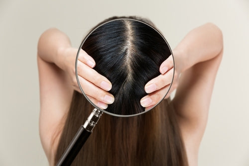 Crown Hair Thinning in Women